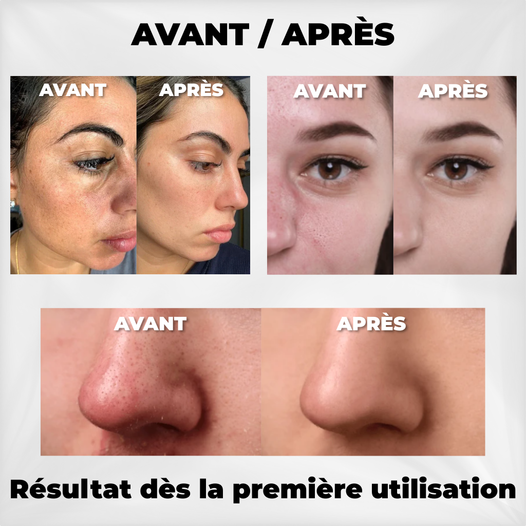 Dr. Melaxin - Exfoliant Coréen Éclat et Pureté Instantanés